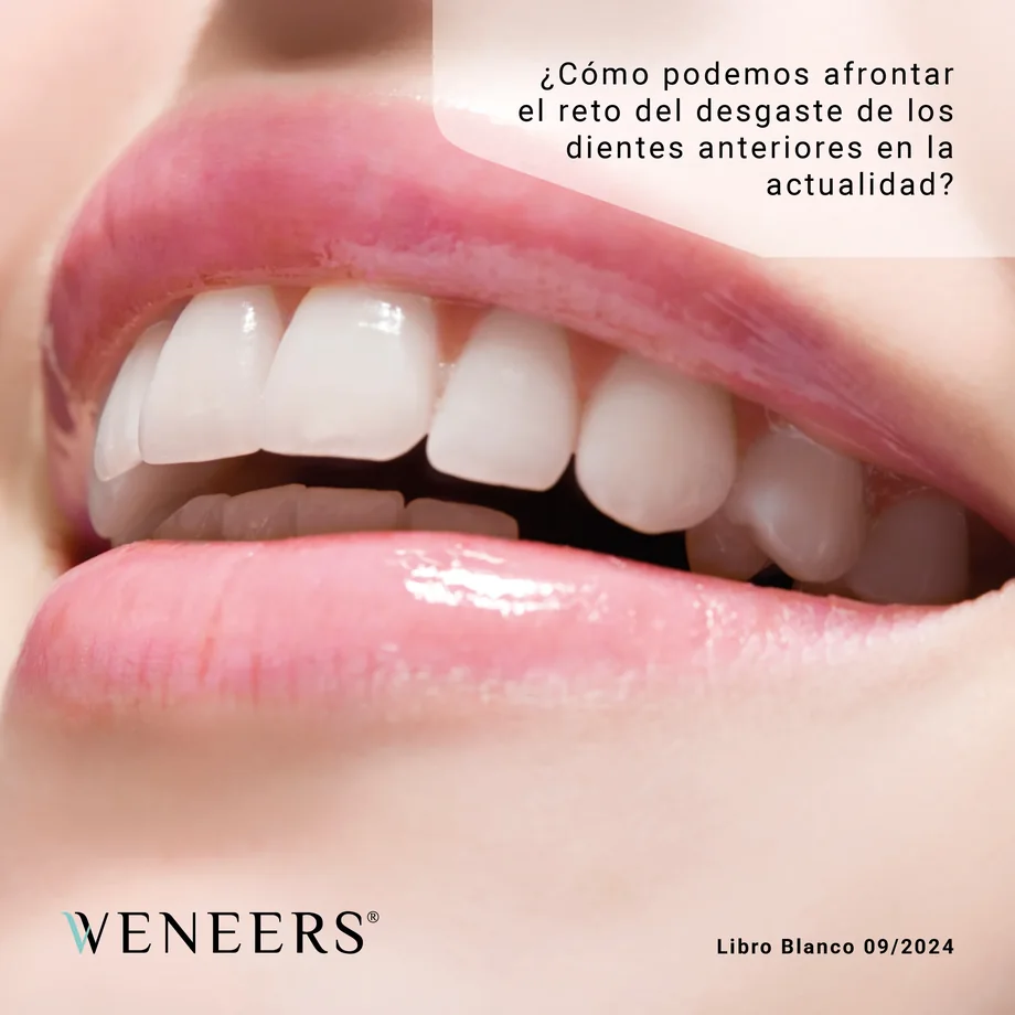 Portada del Libro Blanco Weneers