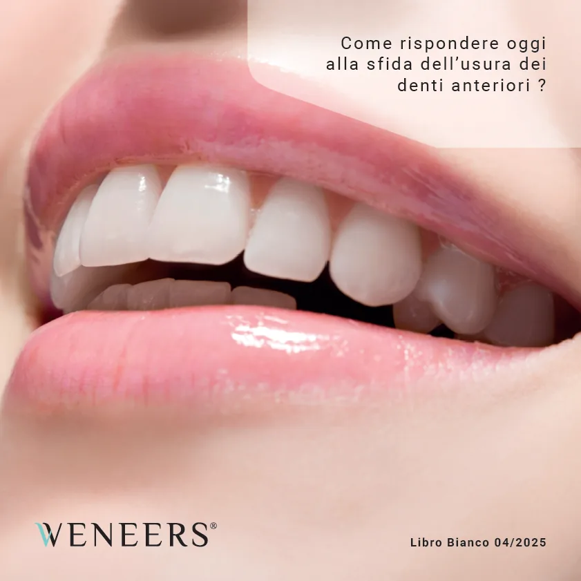 Copertina del Libro Bianco Weneers