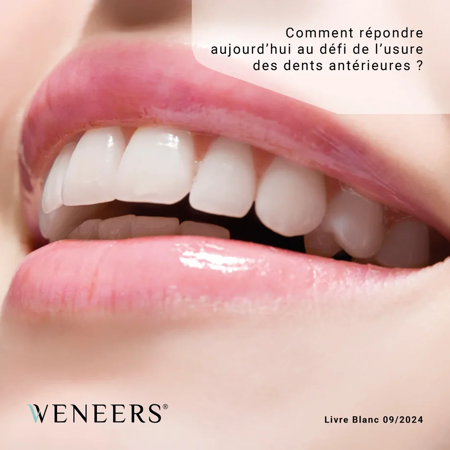 Couverture du Livre Blanc Weneers